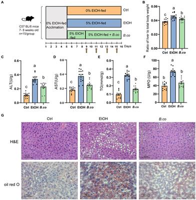 Bacillus coagulans regulates gut microbiota and ameliorates the alcoholic-associated liver disease in mice